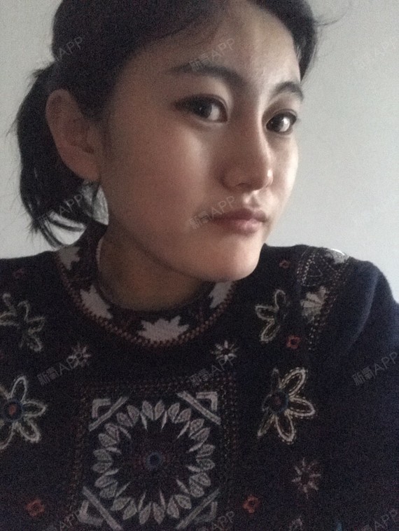 从小被人家说是月亮脸下巴太翘笑起来更突出鼻基底合适_圈子-新氧美容