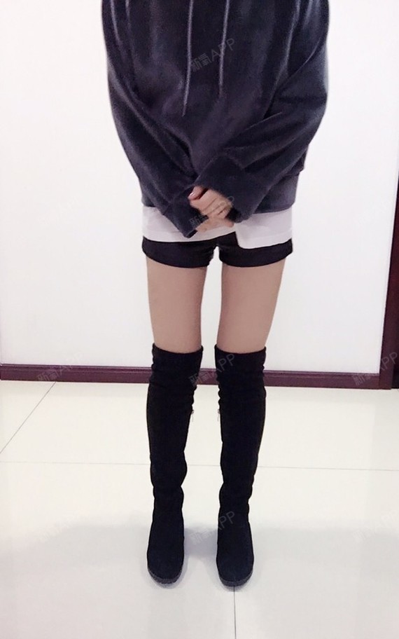 吸脂部位:大腿环吸膝盖臀下臀外侧————————我_圈子-新氧美容