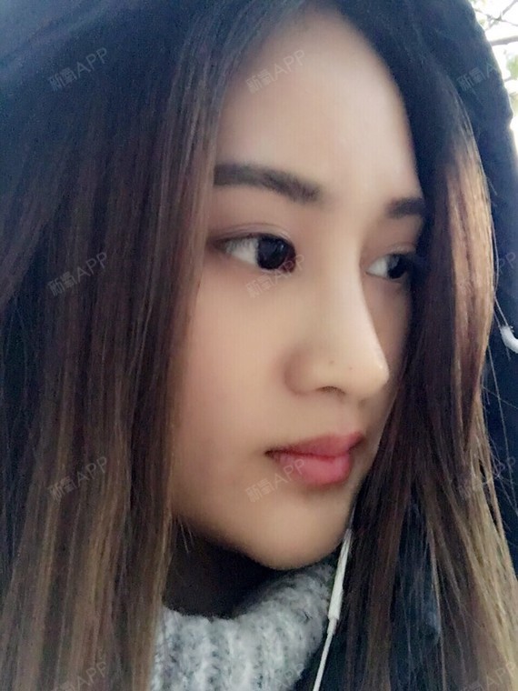 做了线雕隆鼻加了鼻小柱之后,鼻头就有一个凸起的小点_圈子-新氧美容