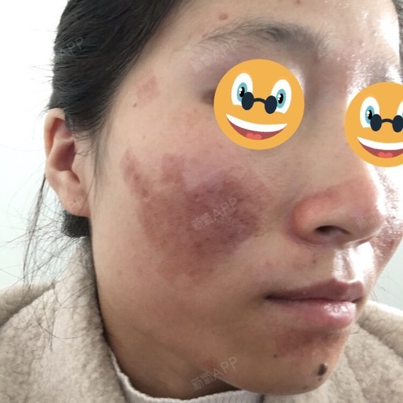 等着蜕变吧