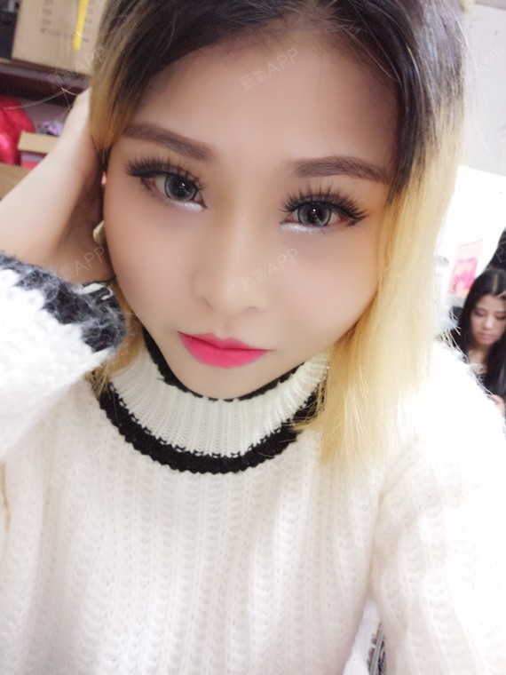 颌面矫正手术是个笼统的说法,具体分为上颌前