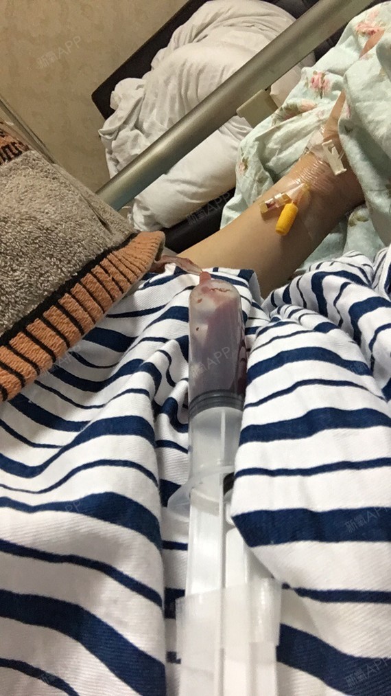 假体隆胸好不好_效果图_麦丽素是解药假体隆胸术后第275天_新氧美容