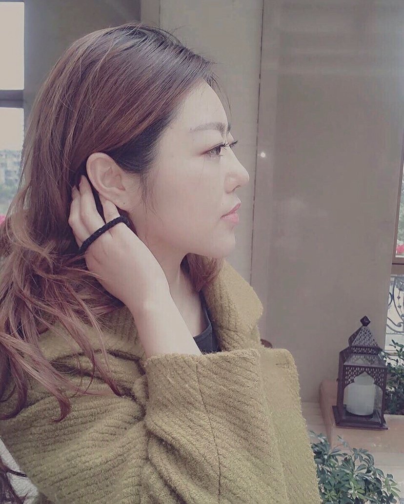 这是刚准备出医院时候朋友拍的,额头一下就饱满啦