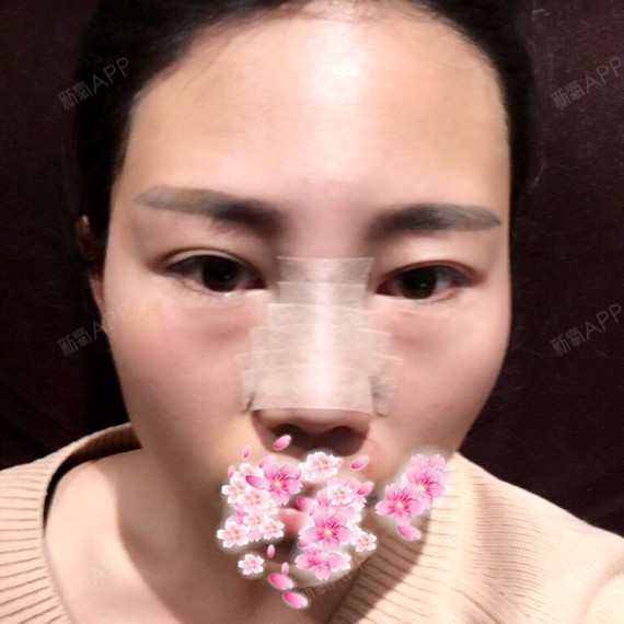 刚做完做完手术