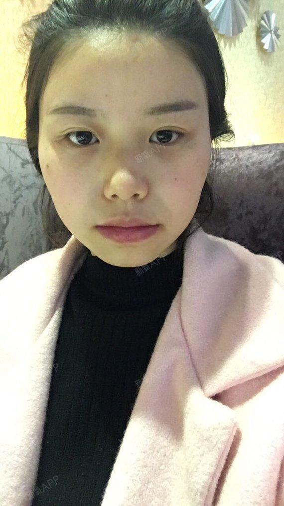 眼角有点上翘的感觉怎么回事?