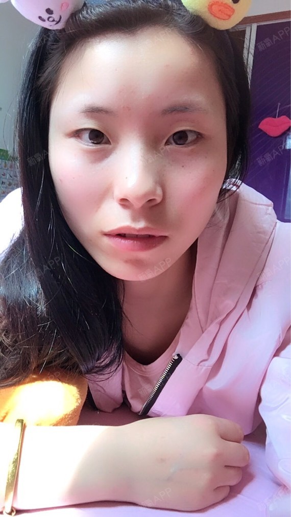 内眼角尖眼尾还上扬有点斗鸡眼,怎么改善看着不那么凶吧?