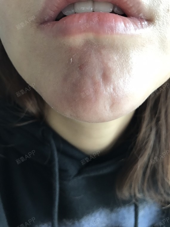 你好,你是在哪里取的奥美定呢,你看我