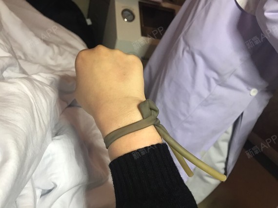 这个照片是第一次打针拍的我皮肤偏黄