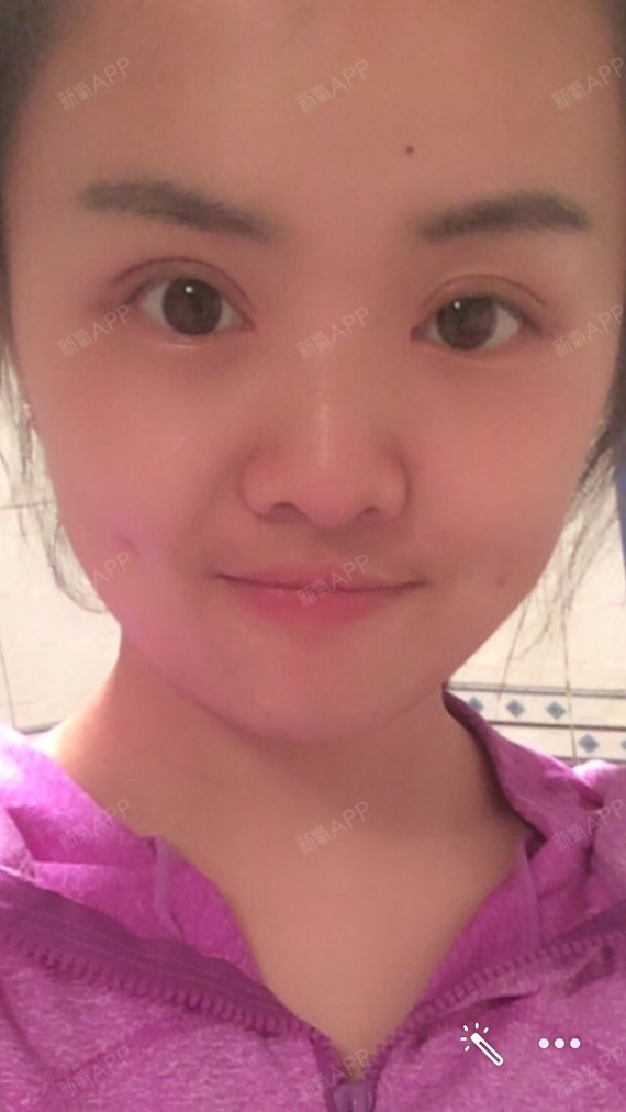 周周啊啊啊开外眼角第29天美丽日记