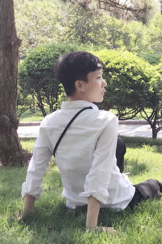 又来分享我的众多90度侧脸45度侧脸各种侧脸了?实_圈子-新氧美容整形