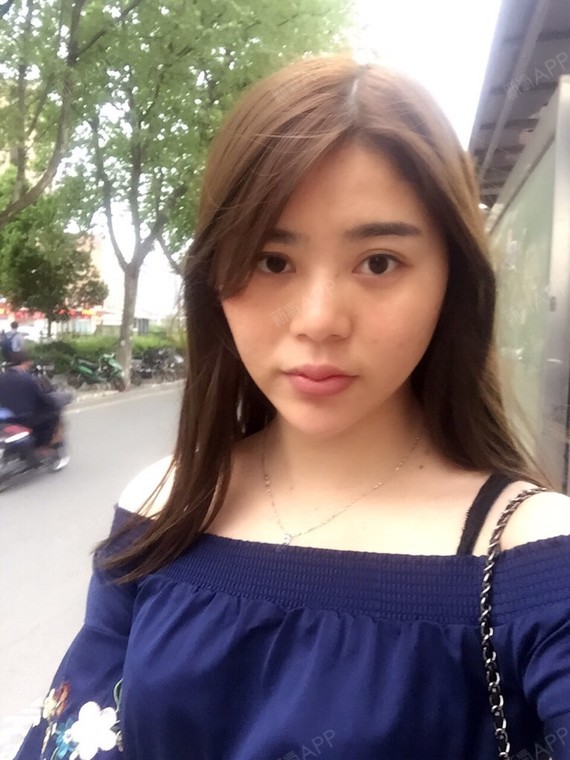 但他不肯,说什么里面有炎症,现在二十天了,感觉像老鼠嘴