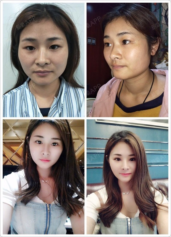 皮肤 | 玻尿酸填充太阳穴 | 激光祛斑 | 眼部综合 | 溶脂针瘦脸