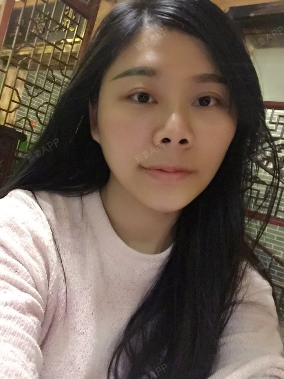 大家看看.鼻孔外露严重～～～我别的地方都是自己的!就是鼻子