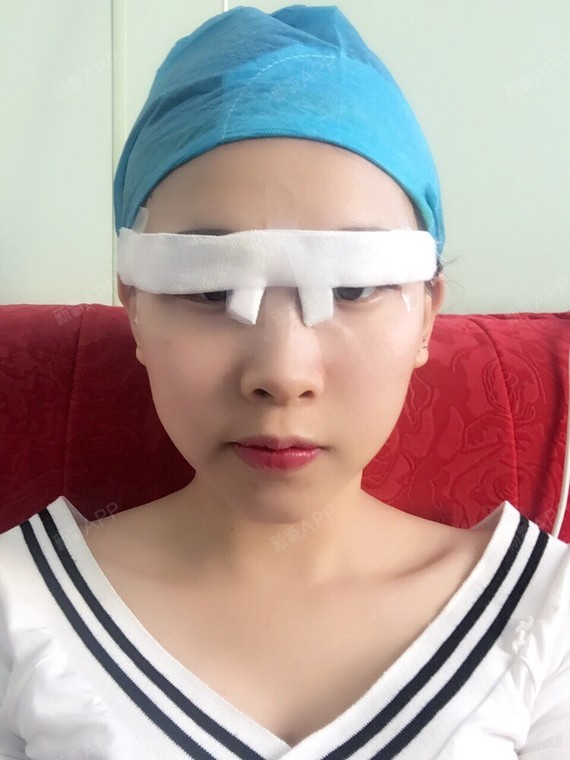 整形美容双眼皮术前消毒（整形美容双眼皮术前消毒多久） 整形美容双眼皮术前消毒（整形美容双眼皮术前消毒多久）《双眼皮术前消毒顺序》 整形美容