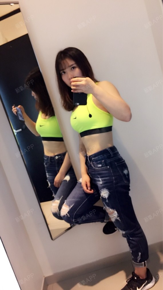 自体脂肪隆胸好不好_效果图_anything93自体脂肪隆胸术后第102天_新氧