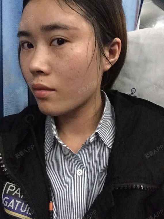我天生左右脸不对称,颧骨一边大一边小,嘴唇因为骨头_圈子-新氧美容