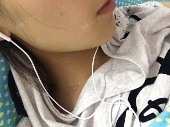 成都注射瘦脸好不好_效果图_氧气veef097注射瘦脸术