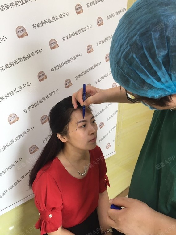 今天刚在东美填充太阳穴.和大家分享一下我的感受.