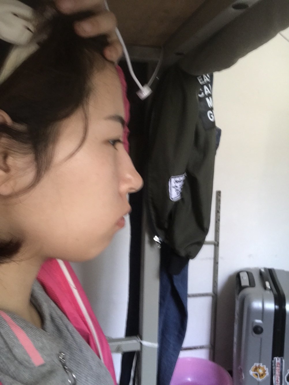 我的是后缩 嘴凹