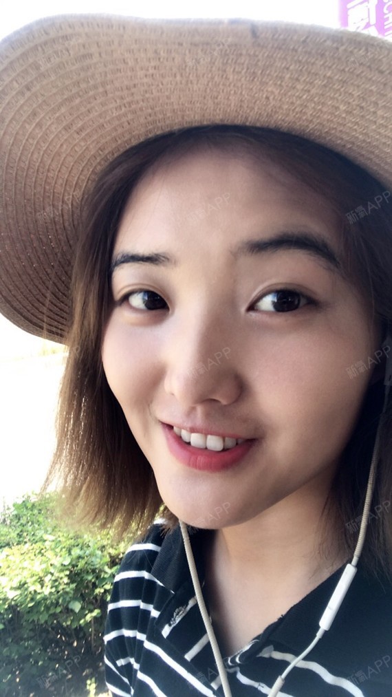 改善宽下巴,求推荐的玻尿酸