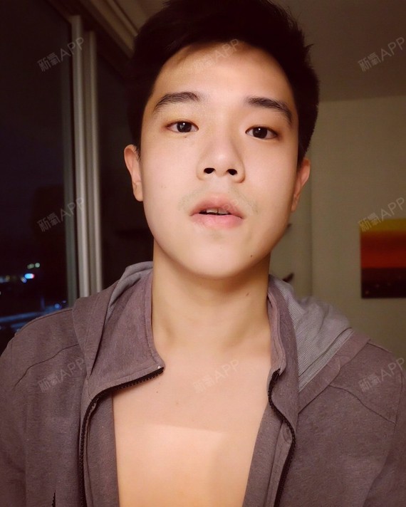 脱唇毛好不好_效果图_氧气dmv3c80脱唇毛术后第0天_新氧美容整形