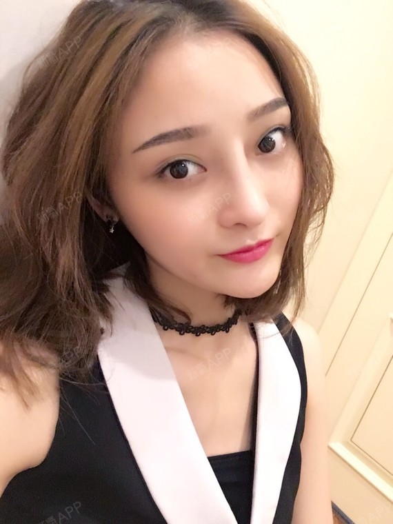 膨体隆鼻好不好_效果图_江夏夏膨体隆鼻术后第17天_新氧美容整形