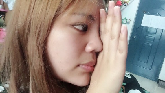 鼻小柱短小_圈子-新氧美容整形