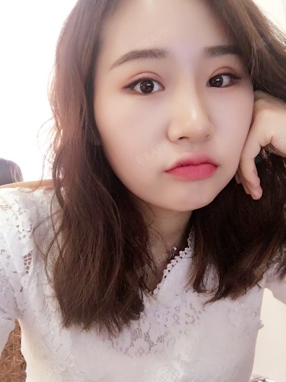 傲娇小黄花开内眼角第9天美丽日记