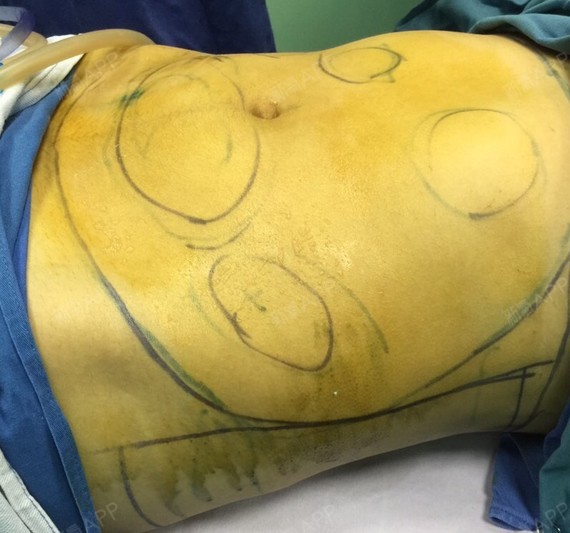 每次来医院人都很多