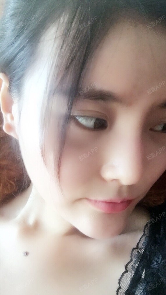 新氧- 网瘾少女ll | 美体塑形 | 自体脂肪隆胸 | 吸脂瘦大腿 | 术后当