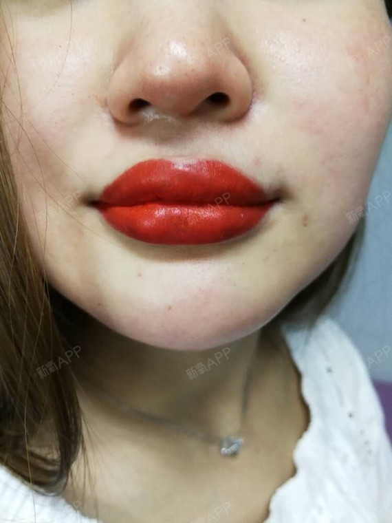 氧气sca8b67半永久纹唇第0天美丽日记-新氧美容整形