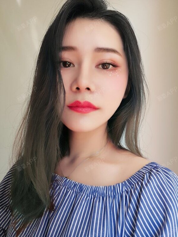 【达拉斯隆鼻135天】【自体脂肪填充全脸】鼻子已经_圈子-新氧美容