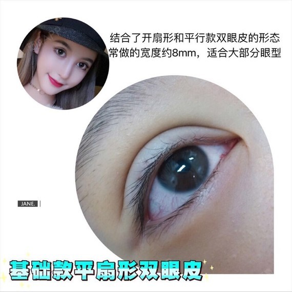 欧式混血,泰式芭比,韩式无辜,基础款,总有一款适合_圈子-新氧美容整形