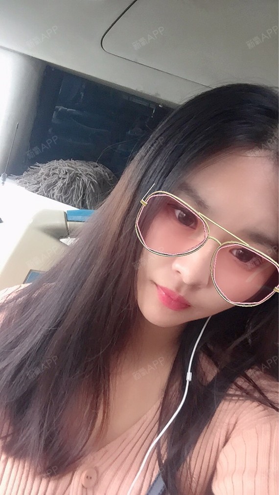 daisy小悦悦切开双眼皮第76天美丽日记