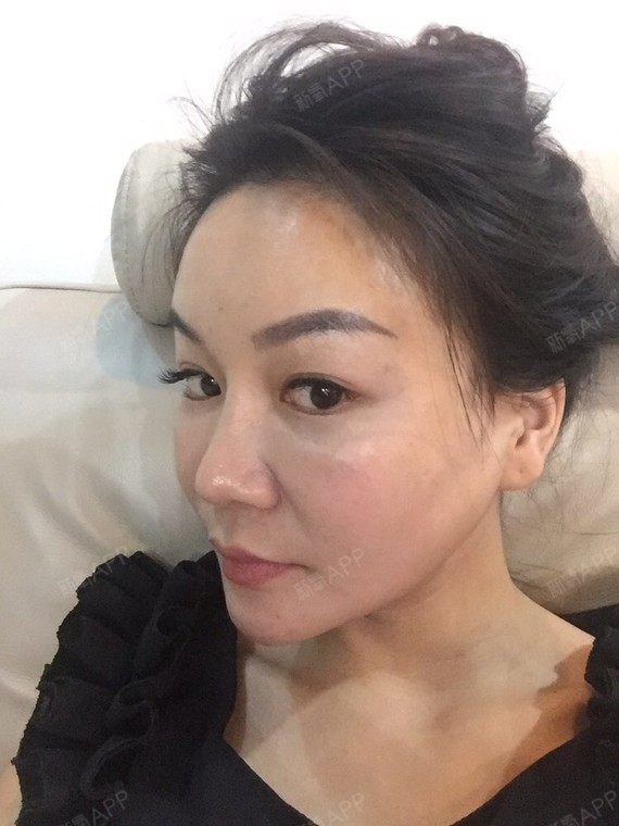 啦……太煎熬了,平时喜食酸辣脆硬的食物,特殊时期酸辣是无忌口在继续