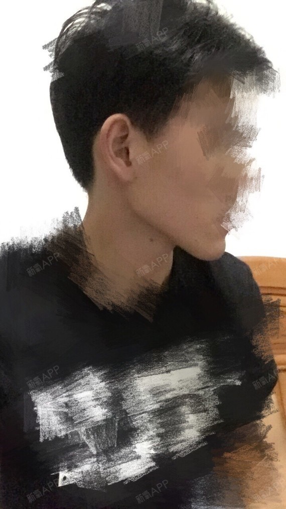 我是下颚骨两边不对称_圈子-新氧美容整形