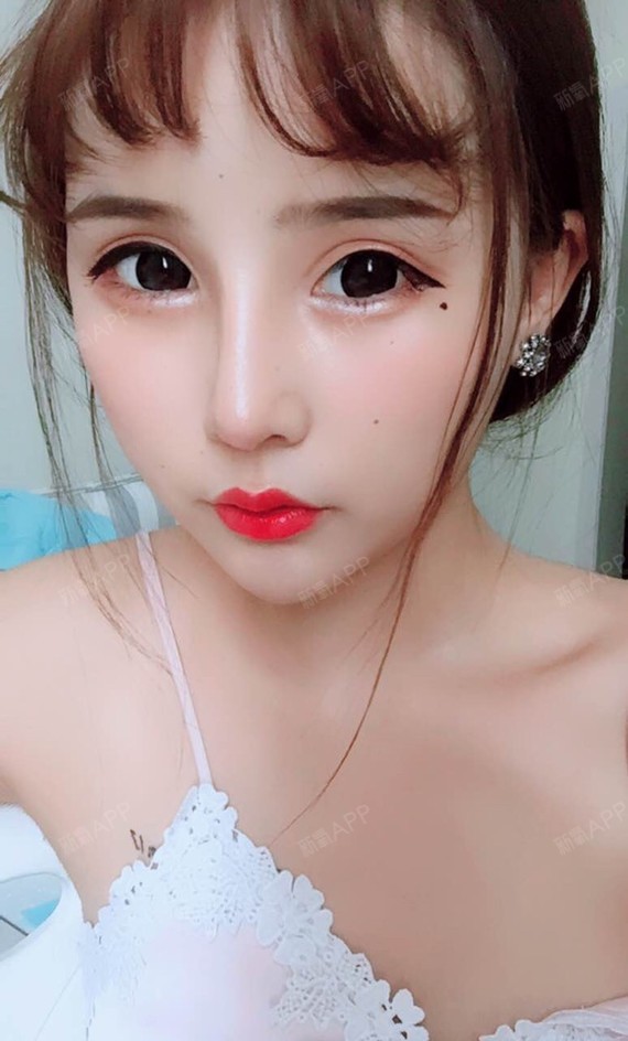 新氧- 小狮子喵喵 | 美容美妆 | 鼻部 | 面部轮廓 | 激光美肤 | 隆鼻