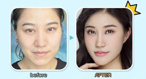 【长沙爱思特&新氧app直播预告】直播时间_圈子-新氧美容整形