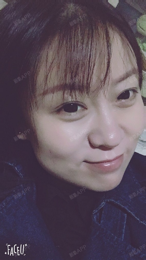 照片拍的有些近距离,看着好恐怖,大饼脸的我,困扰了_圈子-新氧美容