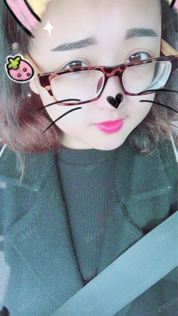 成都切开双眼皮好不好_效果图_琪妹儿77切开双眼皮