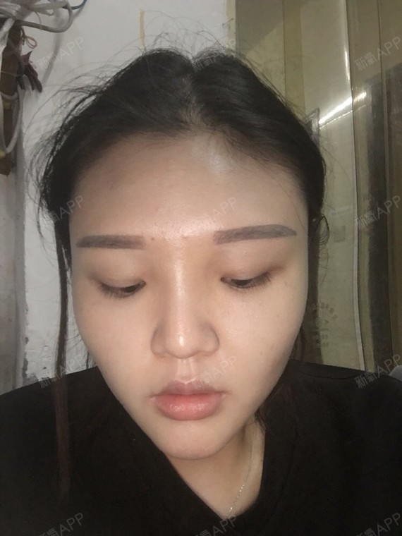 天啦 哈哈哈哈哈哈哈哈哈最近比较忙都没啥时间更新鼻子恢复的还可以