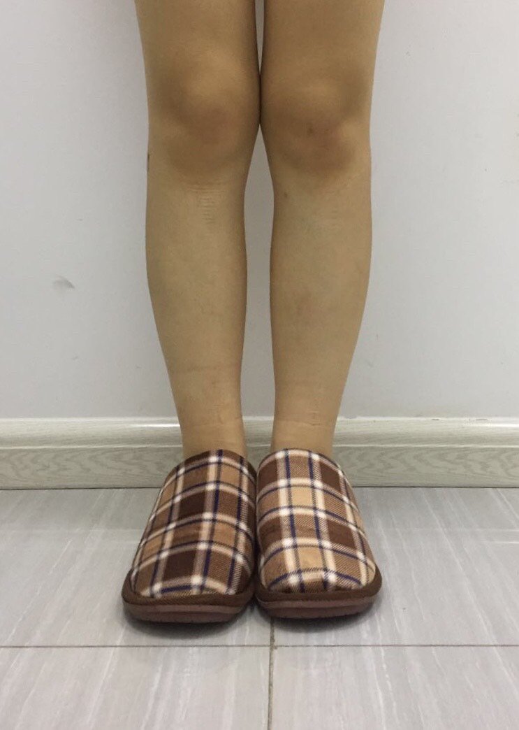 吸脂瘦小腿第9天