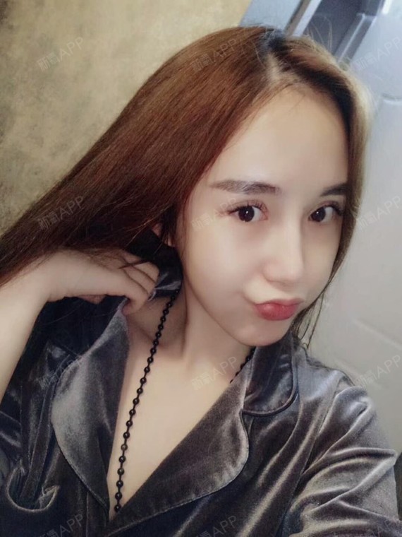 重庆眼部修复好不好_效果图_甜心jj眼部修复术后第59天_新氧美容整形