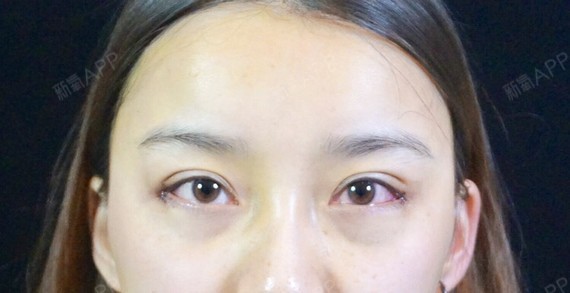 我一直觉得自己的眼睛还算不错,就是眼角上吊很明显,总之就是怎么看