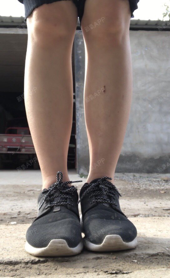 就这样不一样肉毒素瘦小腿第27天美丽日记