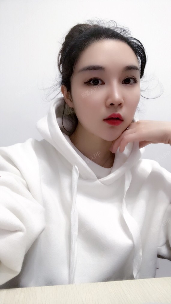 润百颜玻尿酸丰眉弓第二天   [苏乾泰医生]