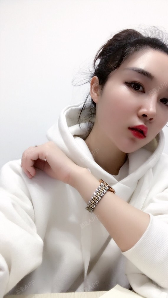 润百颜玻尿酸丰眉弓第二天   [苏乾泰医生]