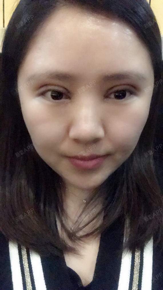术后当自强