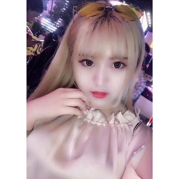 【上海微蓝医疗美容医院 面部填充 林楠】