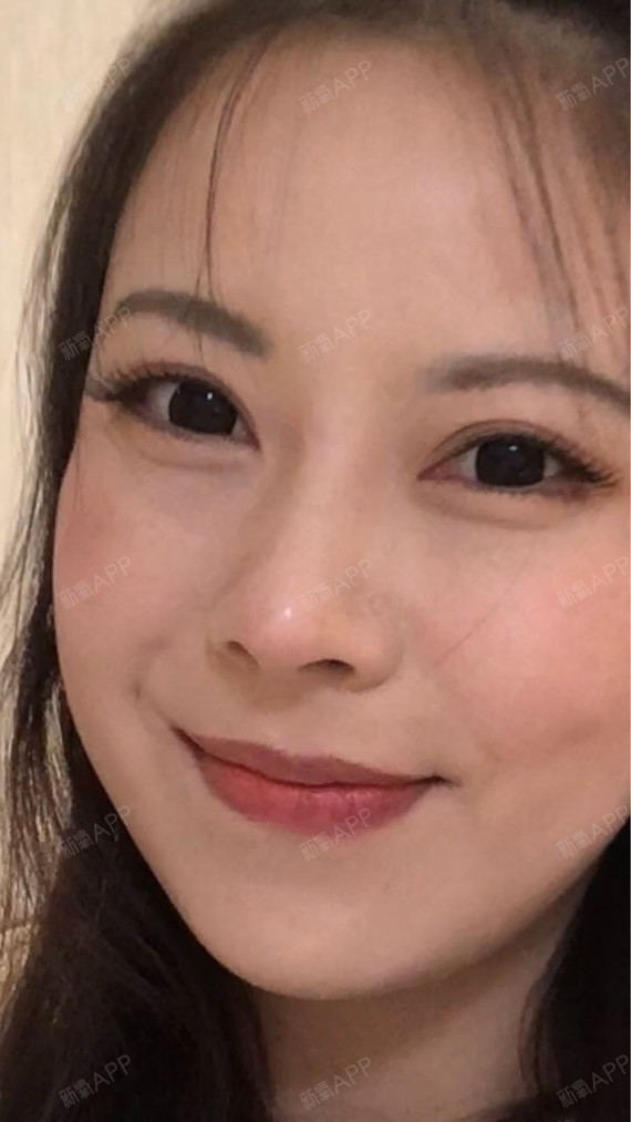 正面鼻子图,生活中很自然没有人觉得我的鼻子时做过的_圈子-新氧美容